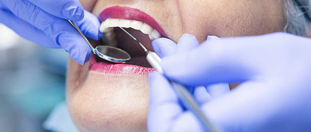 Best Emergency Dentist for Lost Fillings or Crowns in , MS